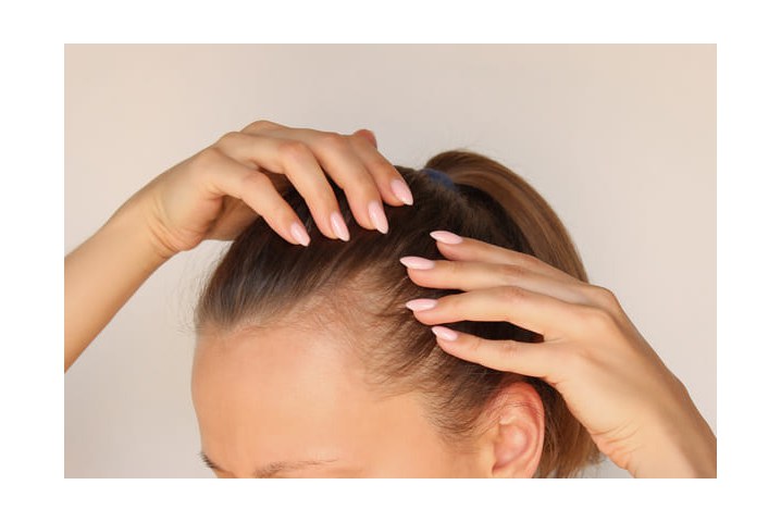 Gęsta fryzura bez widocznych blizn. Dlaczego metody FUE i DHI dają najbardziej naturalne efekty?